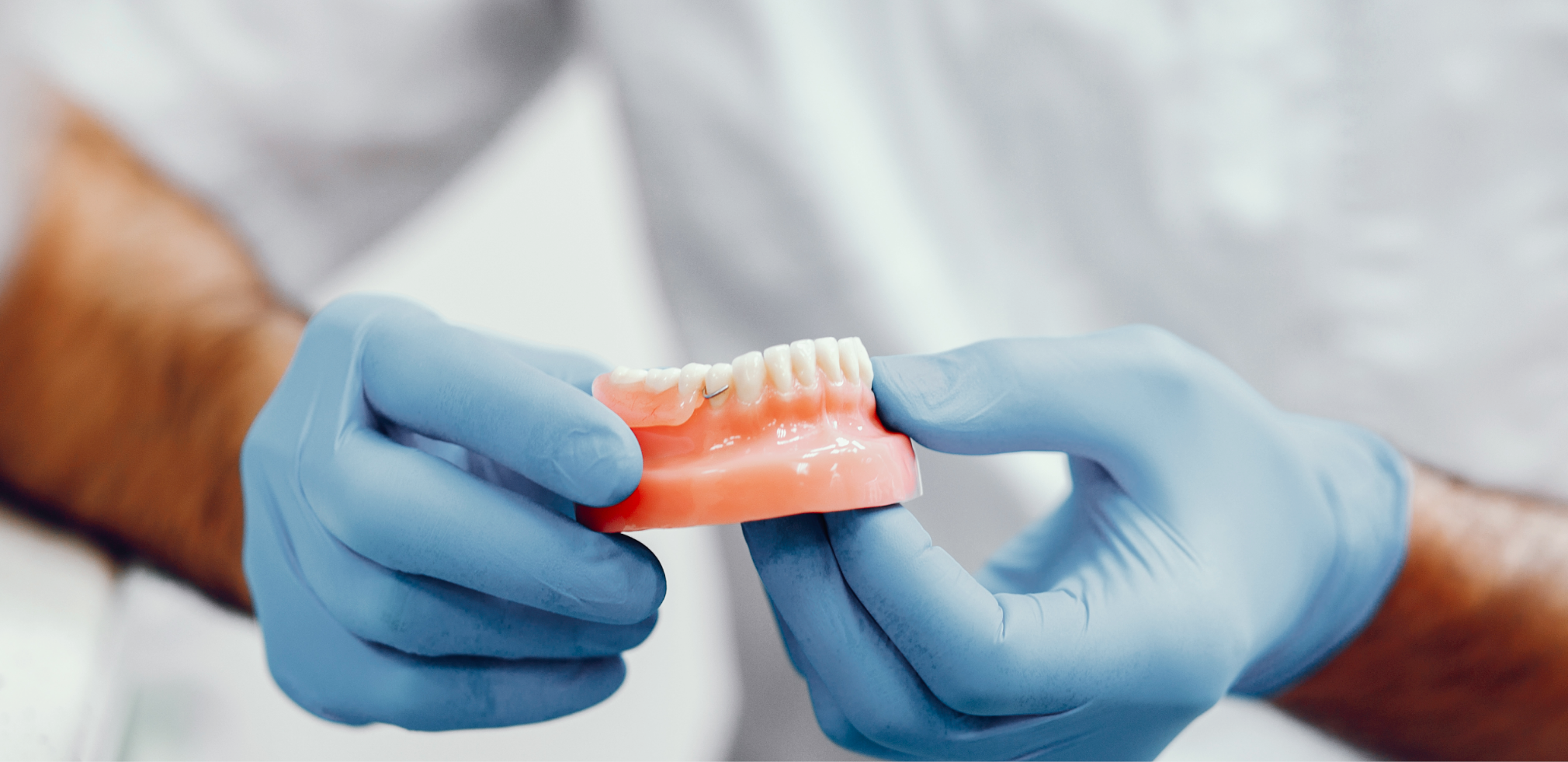 可摘义齿修复学科